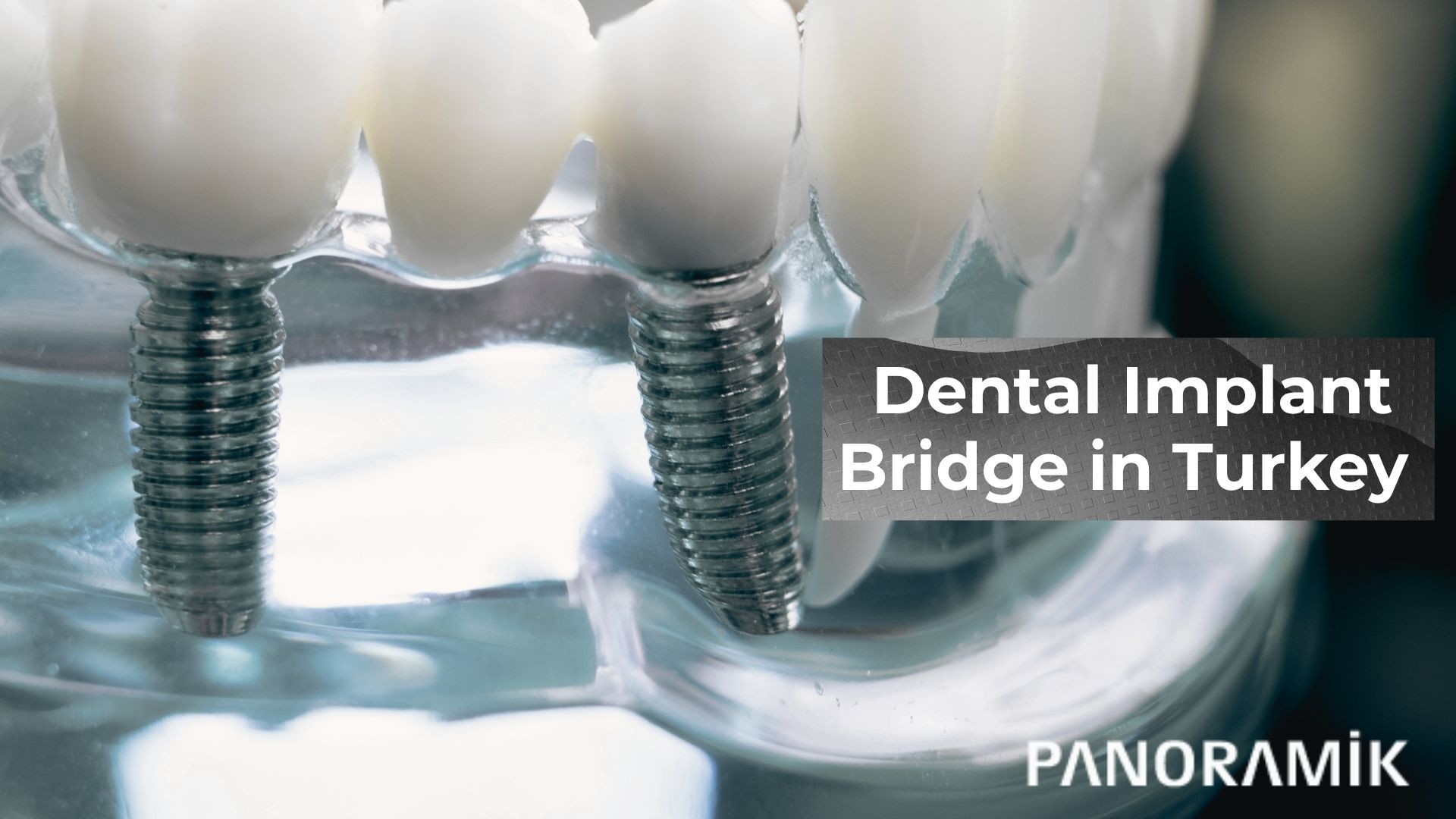 Dental Implant Bridge in Turkey, Antalya?